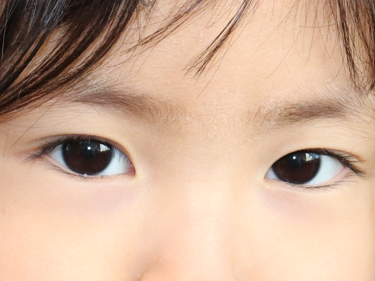 目が悪くなるのは遺伝？子どもの視力を守るためにできること